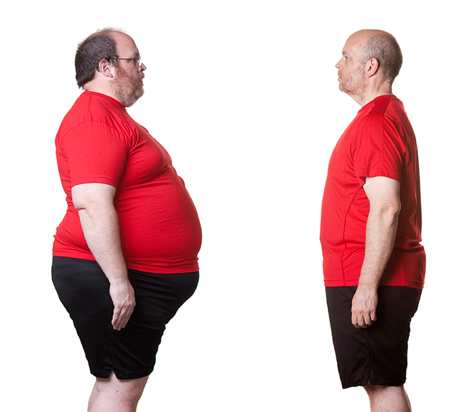 Before-and-after comparison of a man’s weight loss